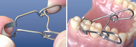 Saddle Contoured Metal Matrices. Universal Kit for Premolars 0,050 mm (36 pcs/box) - TOR VM