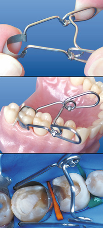 Saddle Contoured Metal Matrices. Universal Kit for Premolars 0,050 mm (36 pcs/box) - TOR VM