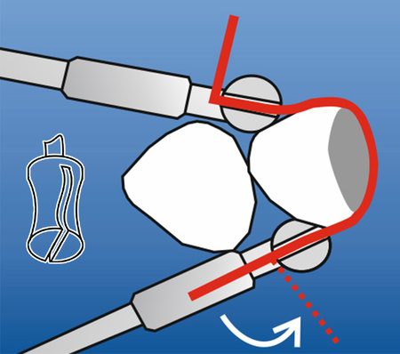 Pony slot springclip