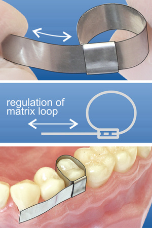 Loop matrices 7 mm (6 pcs box) - TOR VM